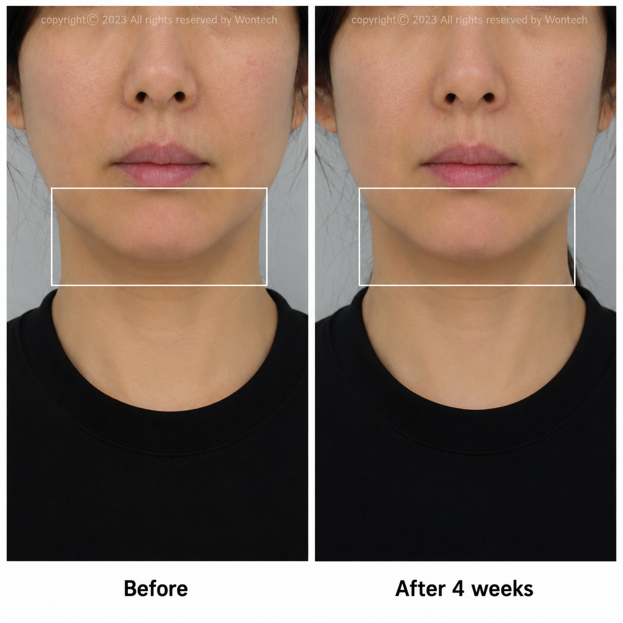 Combination treatment result 01