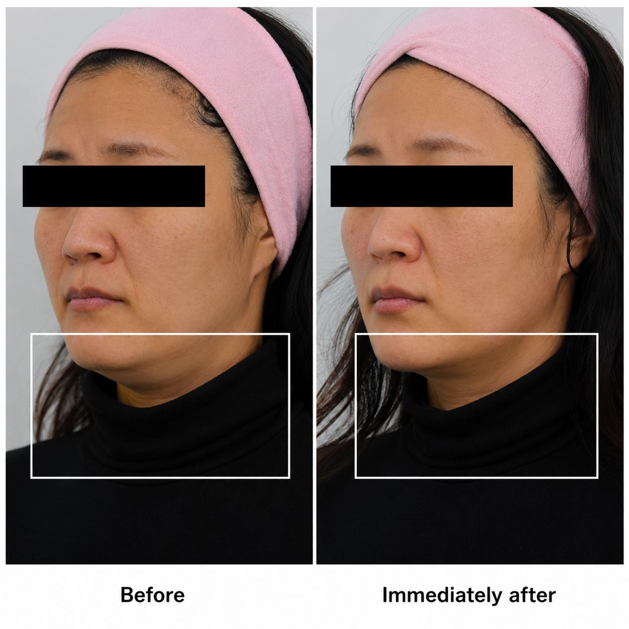 Combination treatment result 02