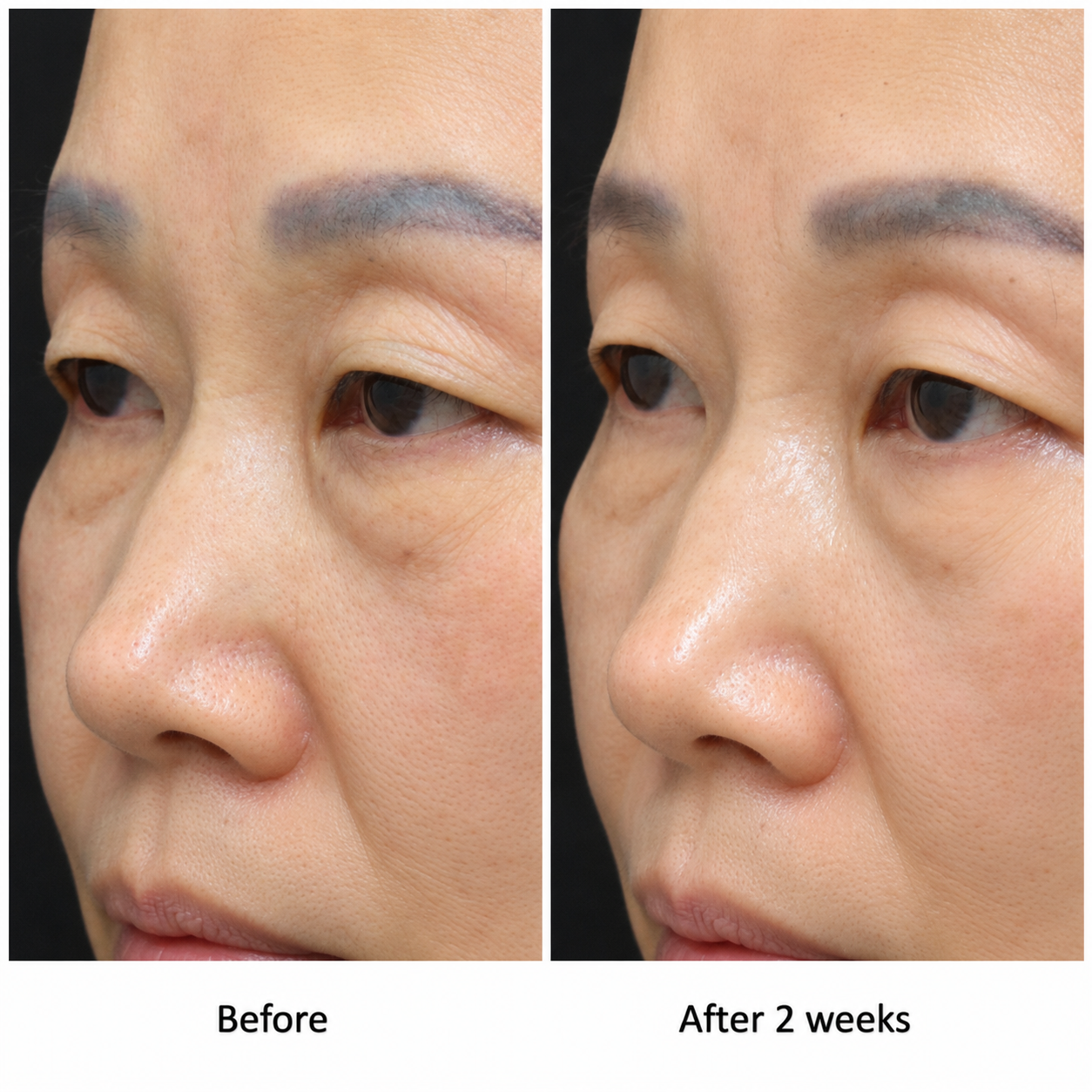 Combination treatment result 03