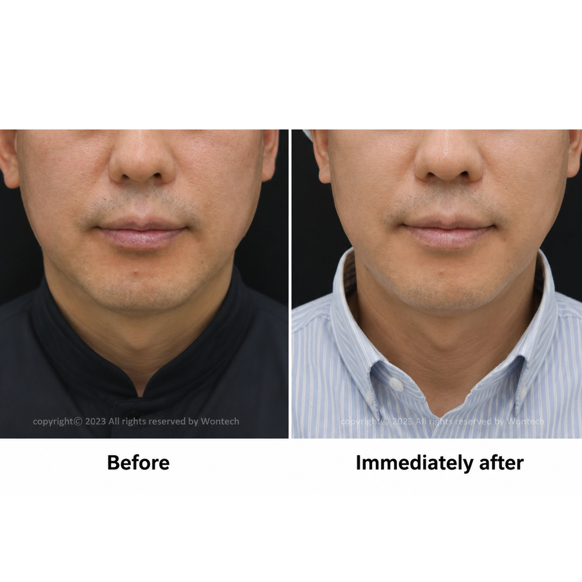 Combination treatment result 04