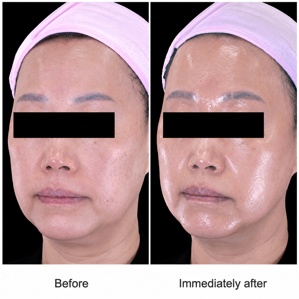 Tightan Pro clinical result 02